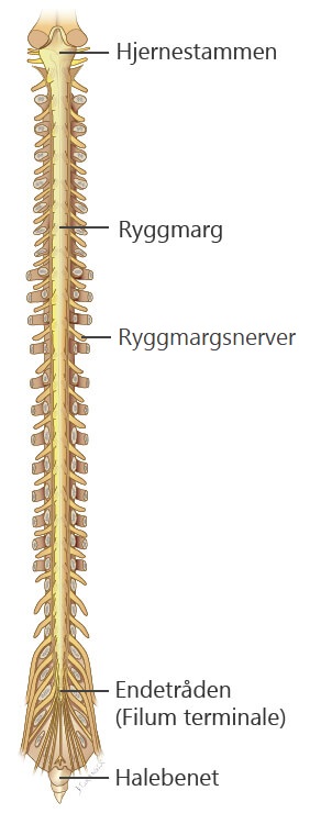 illustrasjon kreft i sentralnervesystemet, intraspinal. Kreftlex.no
