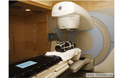 Foto, primær strålebehandling, kreft i svelget.