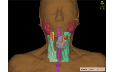 MR-bilde, primær strålebehandling, kreft i svelget.