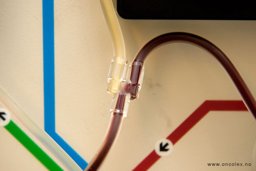 HMAS. Slik utføres stamcellehøsting, ved kreftbehandling