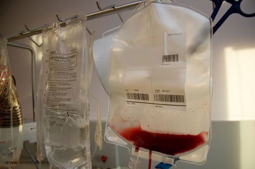 HMAS. Slik utføres stamcellehøsting, ved kreftbehandling