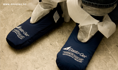 Bruk av kuldehansker og sokker ved kreftbehandling