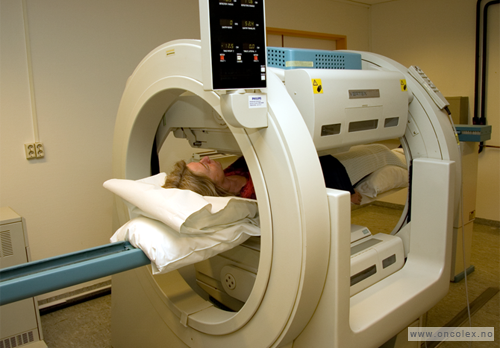 Bilde av skjelettscintigrafi