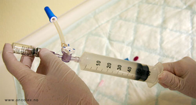 Foto, blæreskylling med BCG.