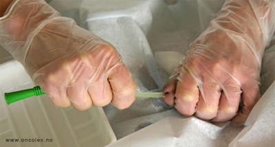 Foto, blæreskylling med BCG. 